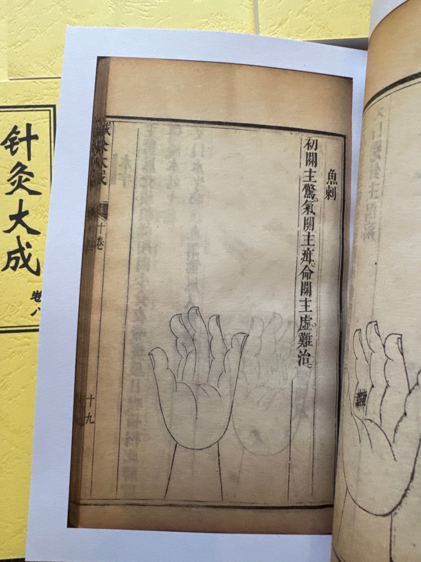 針灸大成